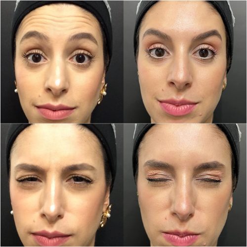 482256417_18271656577268219_4647922885988984776_n