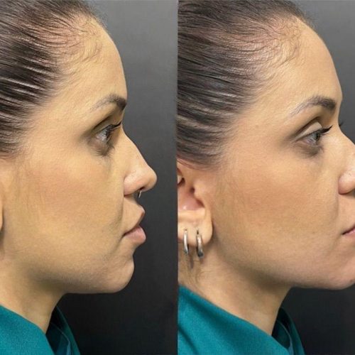 WhatsApp Image 2026-01-12 at 11.31.20 (1)