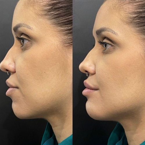 WhatsApp Image 2026-01-12 at 11.31.20 - cópia